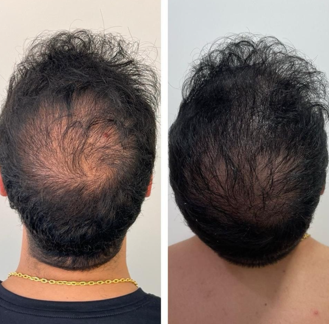 Tratamento Capilar 1