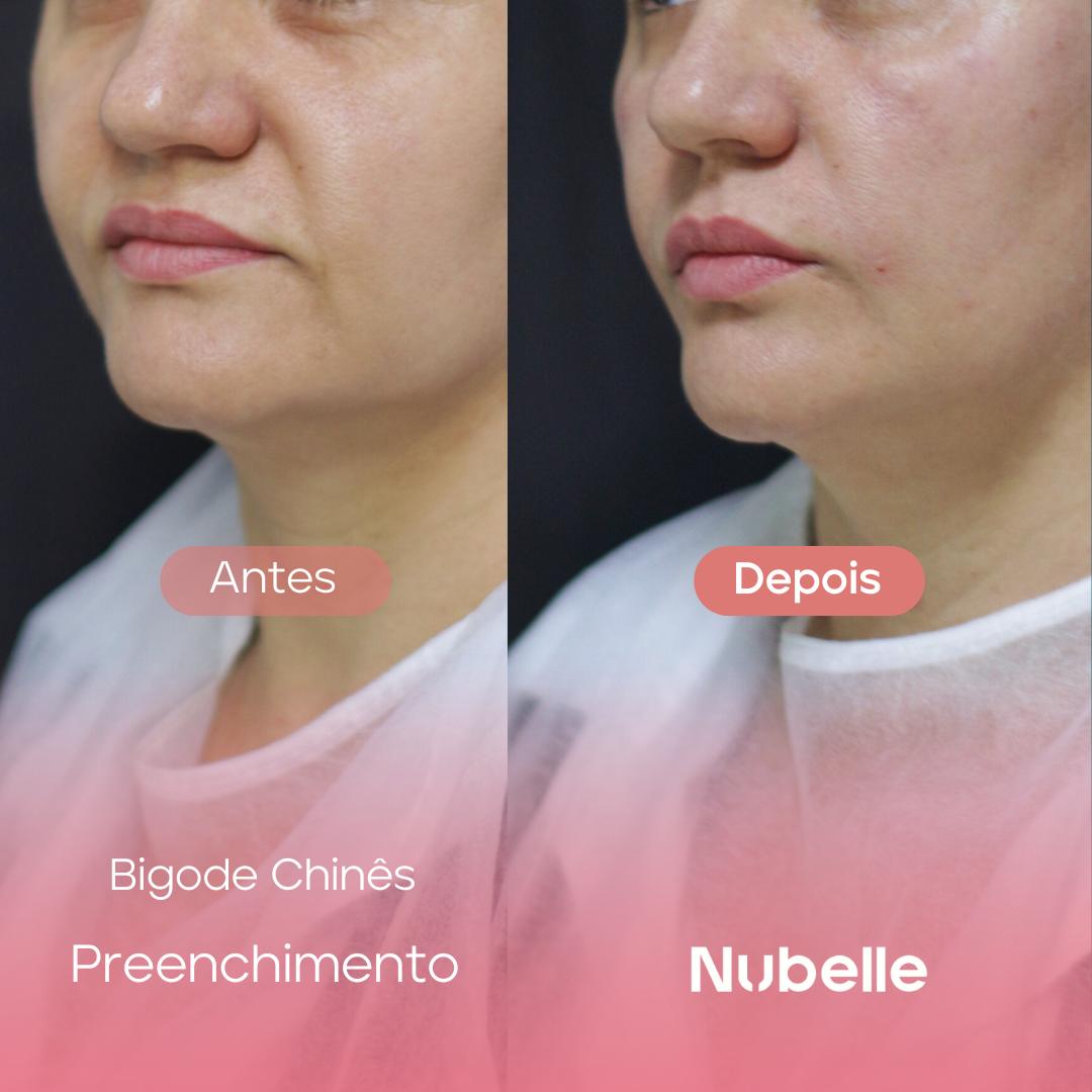 WhatsApp Image 2024-12-03 at 5.22.20 PM