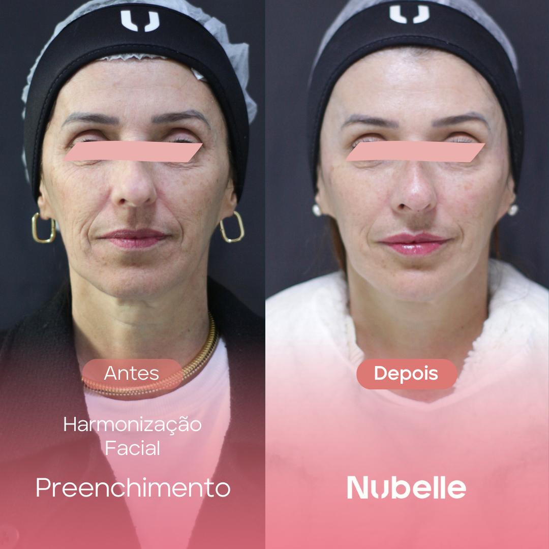 WhatsApp Image 2024-12-03 at 5.27.03 PM