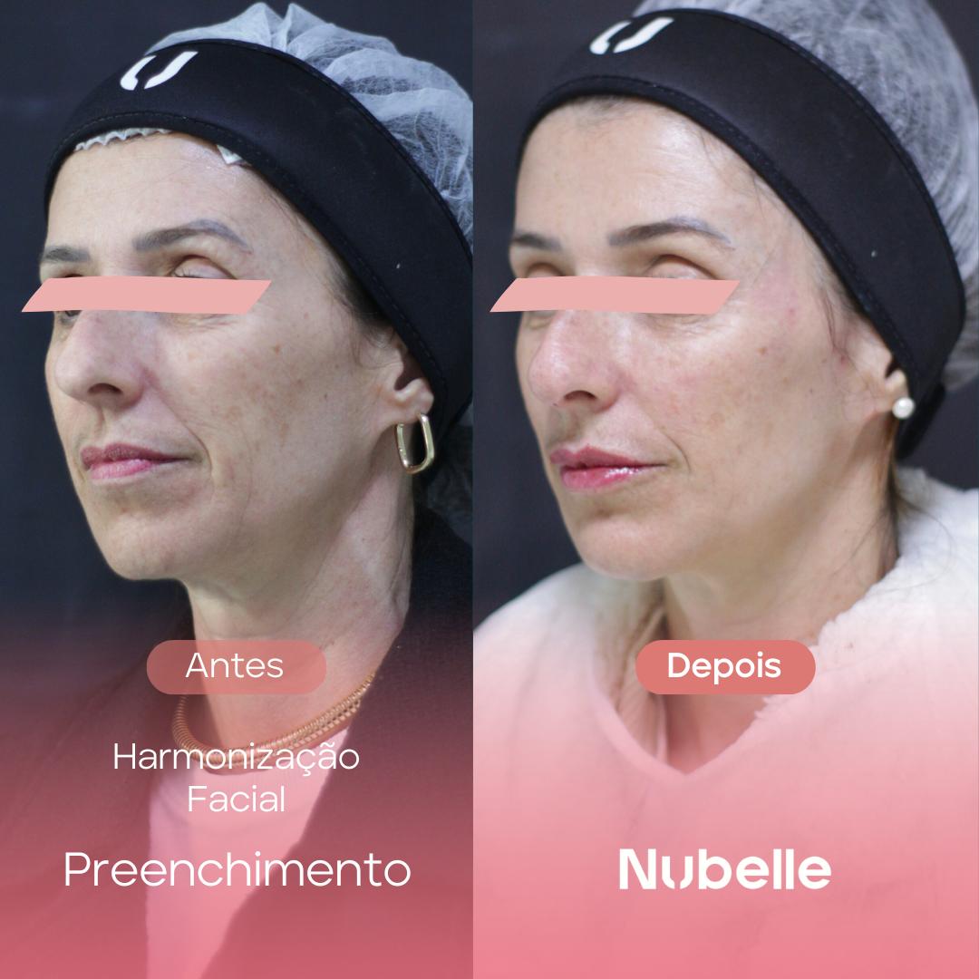 WhatsApp Image 2024-12-03 at 5.27.25 PM