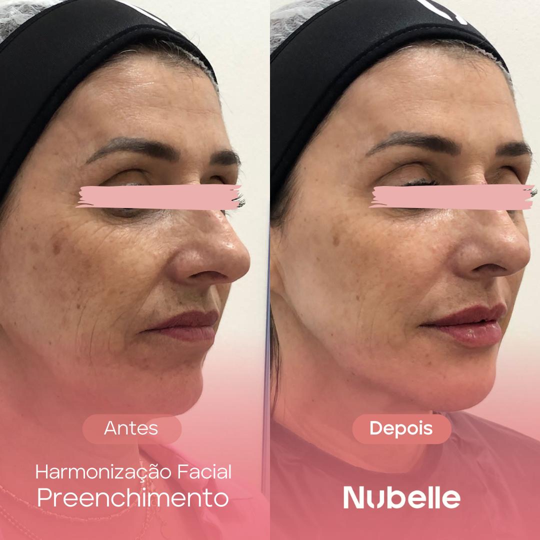 WhatsApp Image 2024-12-03 at 5.28.23 PM