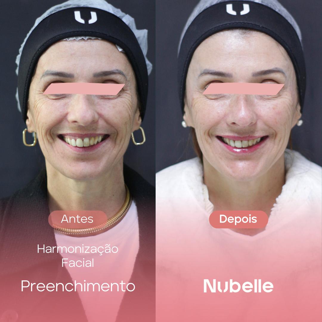 WhatsApp Image 2024-12-03 at 5.28.45 PM