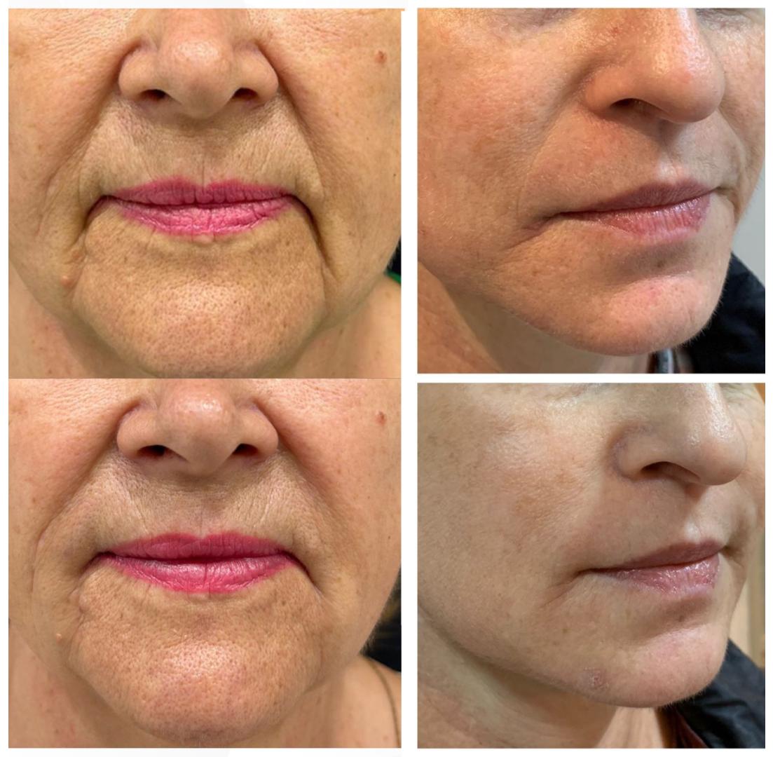 WhatsApp Image 2024-12-11 at 10.10.43 AM