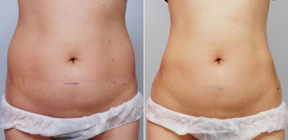 WhatsApp Image 2025-09-03 at 14.28.16