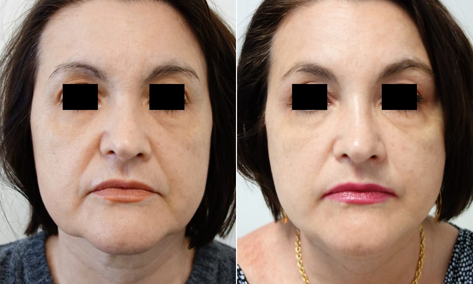 WhatsApp Image 2025-09-03 at 14.28.18